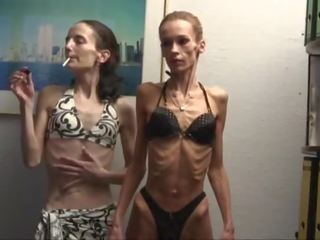 Anorexic ragazze posa in swimsuits e tratto per il macchina fotografica